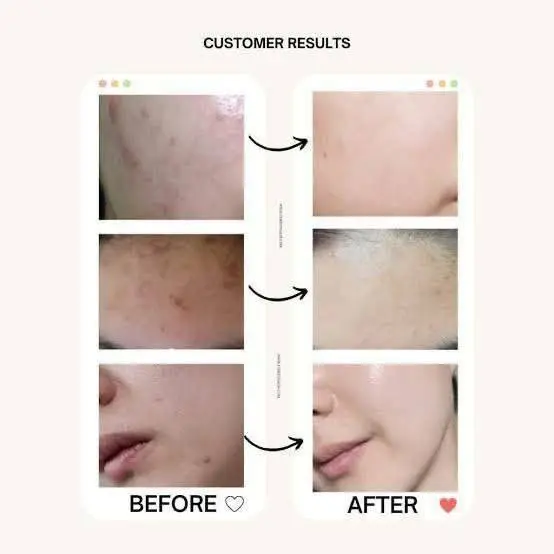 Beauty of Joseon Glow Serum: Propolis + Niacinamide (30ml) - Image 3