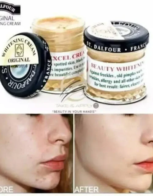 St. Dalfour "Beauty Whitening" Cream (Original Excel)